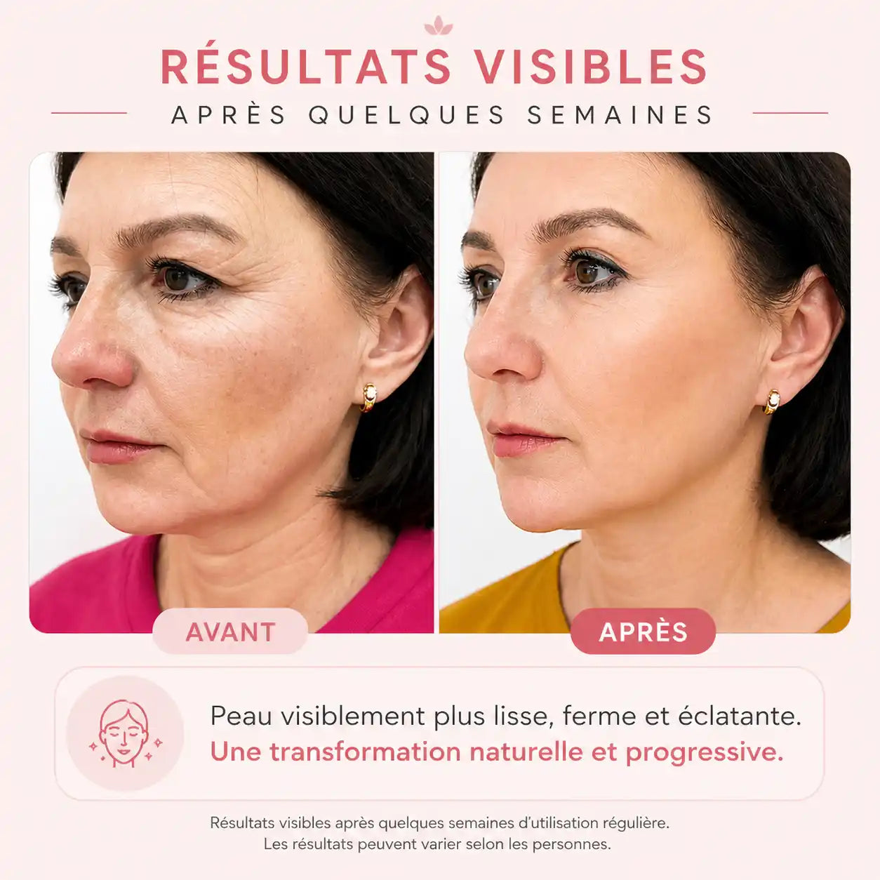 Luminaskyn – Masseur Visage Anti-Rides | Peau Ferme et Liftée en 10 min/jour